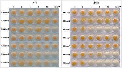 Human Antimicrobial RNases Inhibit Intracellular Bacterial Growth and Induce Autophagy in Mycobacteria-Infected Macrophages